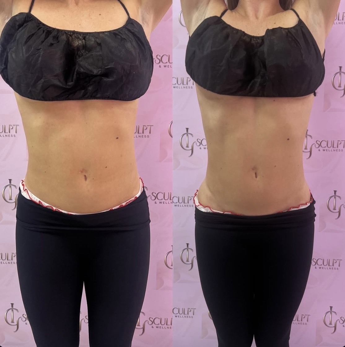 Before and after: It Girl Sculpt Method